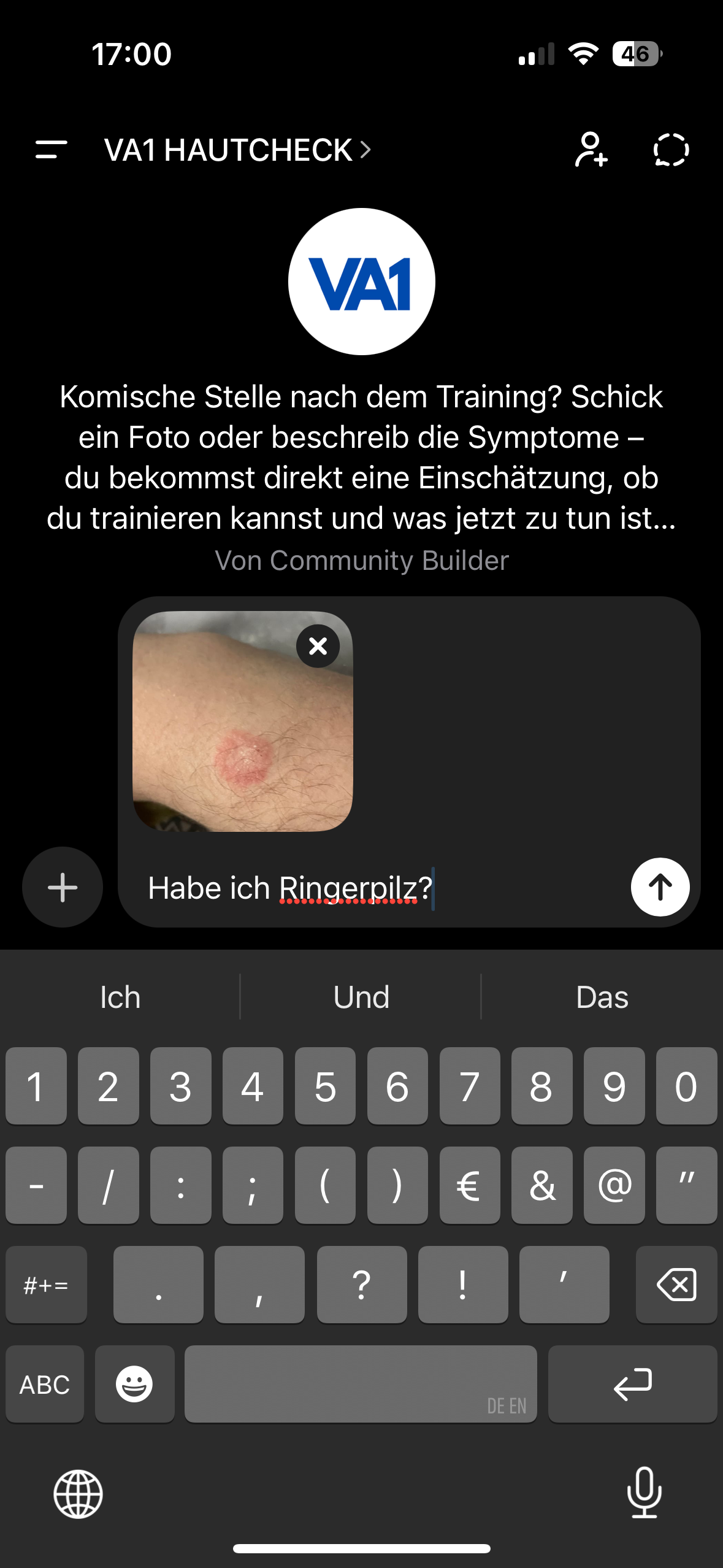 Schritt 2: Frage eingeben