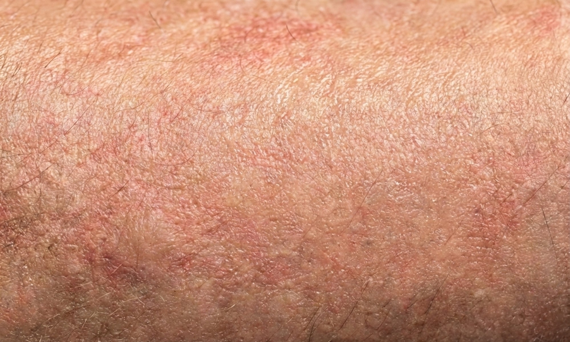 Nahaufnahme gereinigter Haut ohne Rückstände. Nachher-Zustand: Saubere Hautbarriere und erfolgreiche Mat Defense Reinigung nach der Anwendung der VA1 Core Bar.